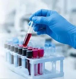 Blood sample tested at Asthra Lab