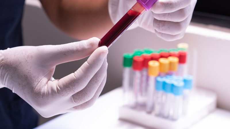 Quick Fit Package at Asthra Lab